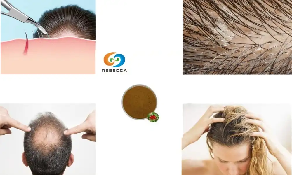 Does rhodiola make your hair grow?